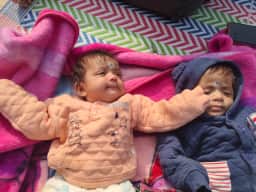 Baby Twins - Growing Together
